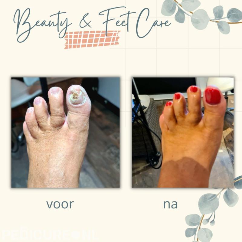 Medisch Pedicure Reinalda Van Zaanen