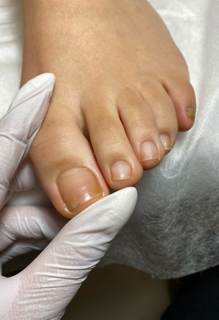 Medische Pedicure & Manicure Natalie En Healthy Beauty Https://MedischePedicureManicureNatalie.boekingapp.nl